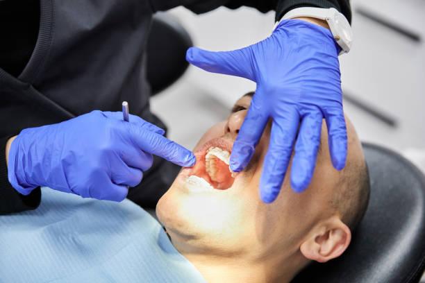 Best Emergency Tooth Extraction in Brownsboro, TX