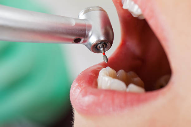 Best Emergency Treatment for Toothache in Brownsboro, TX